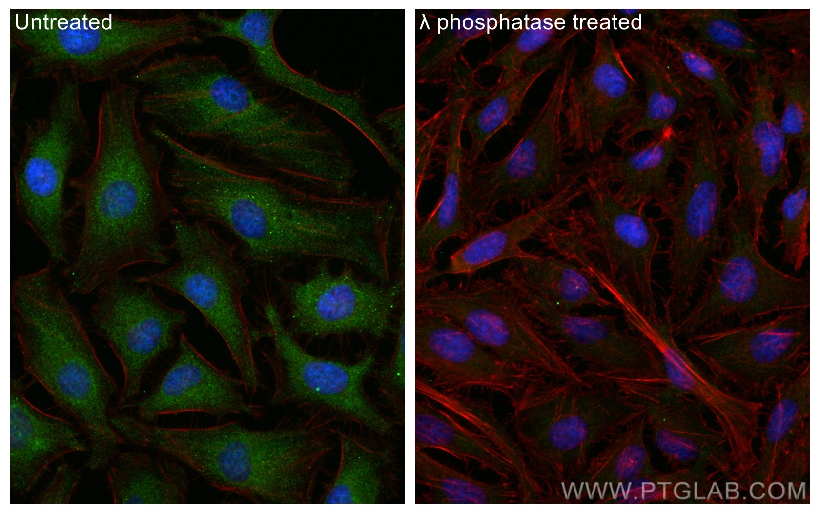 Immunofluorescence (IF) / fluorescent staining of HeLa cells using Phospho-PKC Alpha (Thr638) Polyclonal antibody (29123-1-AP)