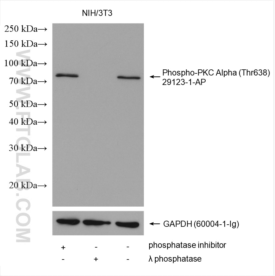 Western Blot (WB) analysis of various lysates using Phospho-PKC Alpha (Thr638) Polyclonal antibody (29123-1-AP)