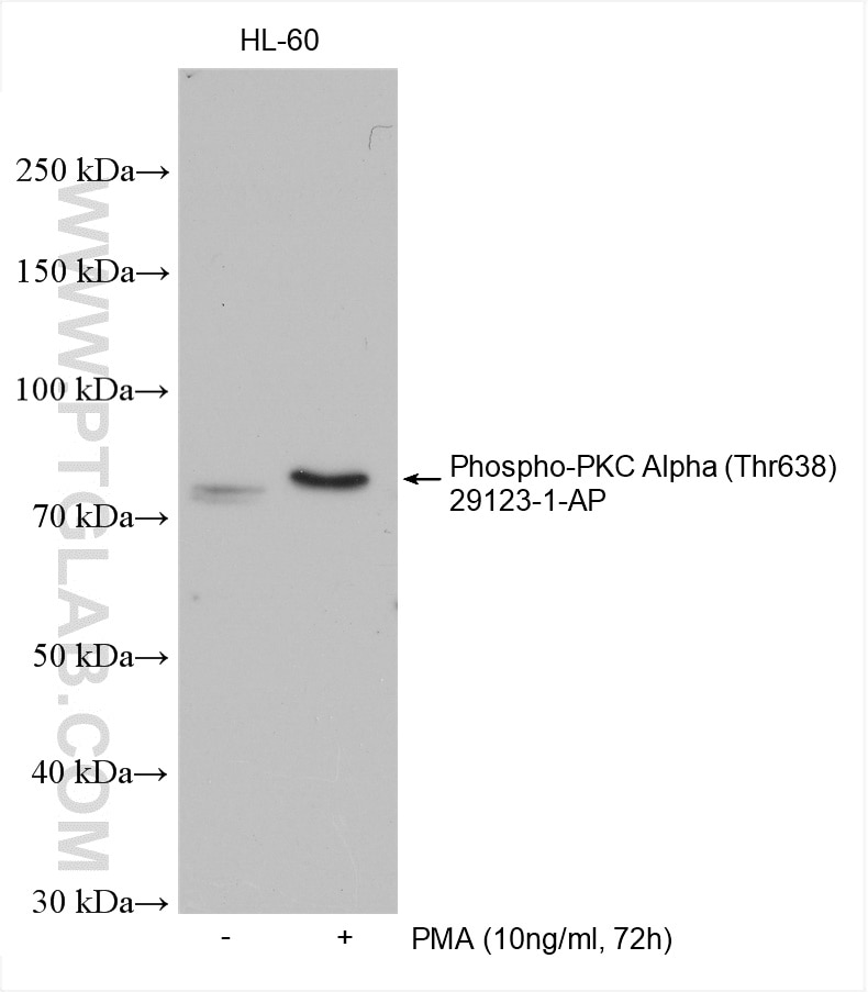 Western Blot (WB) analysis of various lysates using Phospho-PKC Alpha (Thr638) Polyclonal antibody (29123-1-AP)