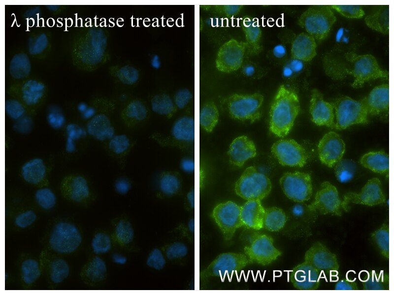 Immunofluorescent analysis of (4% PFA) fixed λ phosphatase treated THP-1 cells using Phospho-PKC Alpha (Thr638) antibody (81575-2-RR, Clone: 241844A10 ) at dilution of 1:400 and CoraLite®488-Conjugated Goat Anti-Rabbit IgG(H+L) (SA00013-2). Immunofluorescence (IF) / fluorescent staining of THP-1 cells using Phospho-PKC Alpha (Thr638) Recombinant monoclonal  (81575-2-RR)