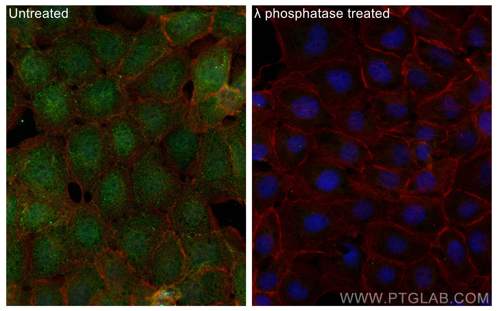 Immunofluorescence (IF) / fluorescent staining of A431 cells using Phospho-PKC Delta (Ser359) Polyclonal antibody (29562-1-AP)