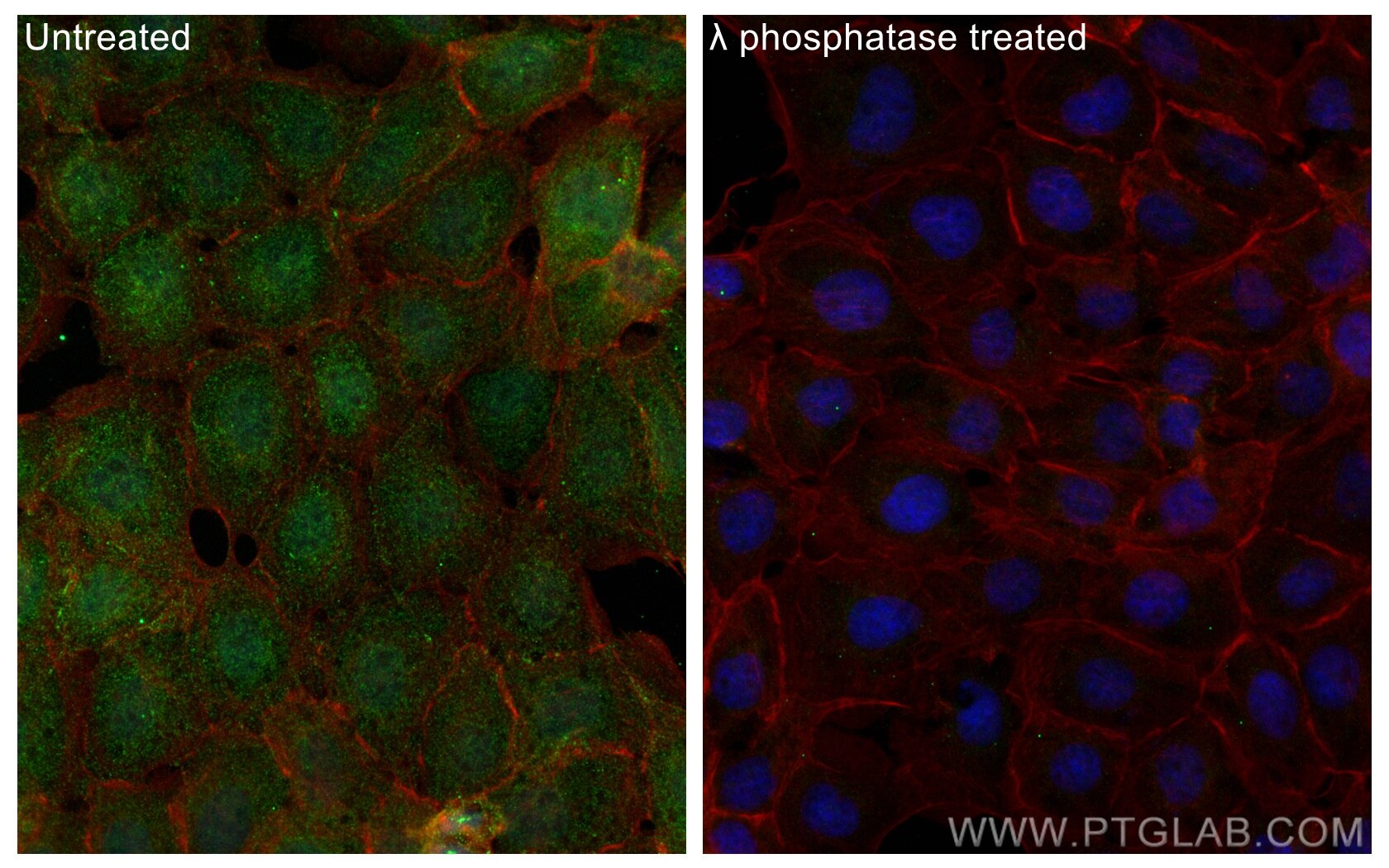 IF Staining of A431 using 29562-1-AP