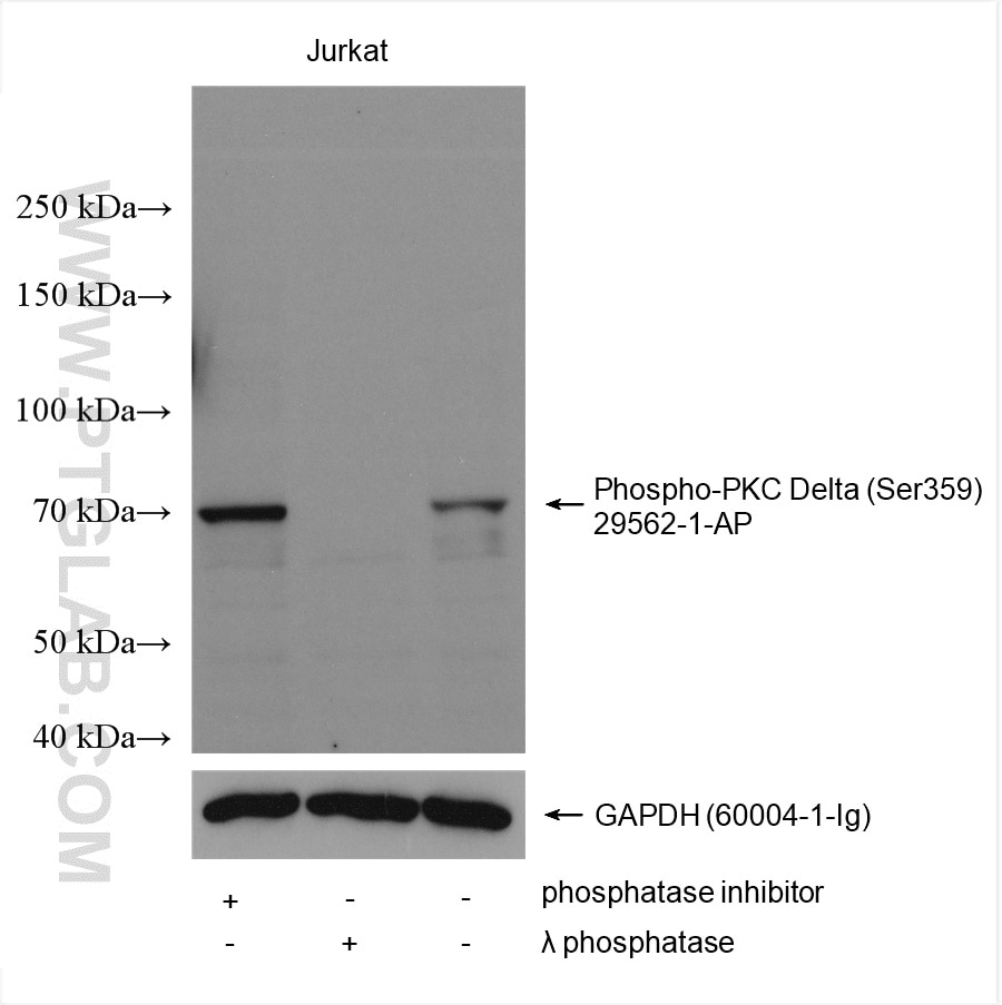 Western Blot (WB) analysis of various lysates using Phospho-PKC Delta (Ser359) Polyclonal antibody (29562-1-AP)