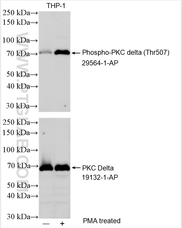 Phospho-PKC delta (Thr507)