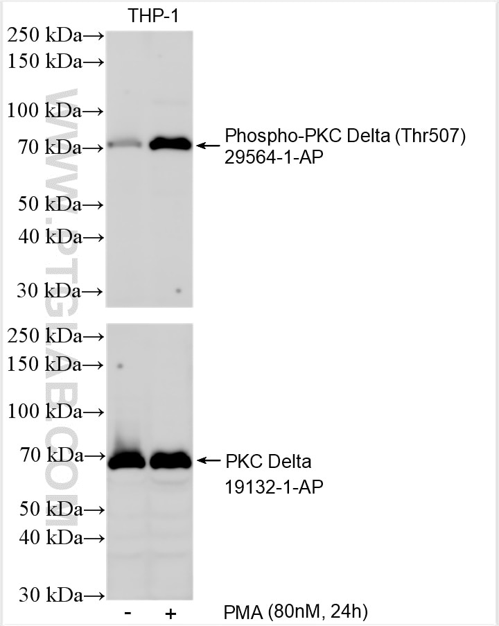 Western Blot (WB) analysis of various lysates using Phospho-PKC delta (Thr507) Polyclonal antibody (29564-1-AP)