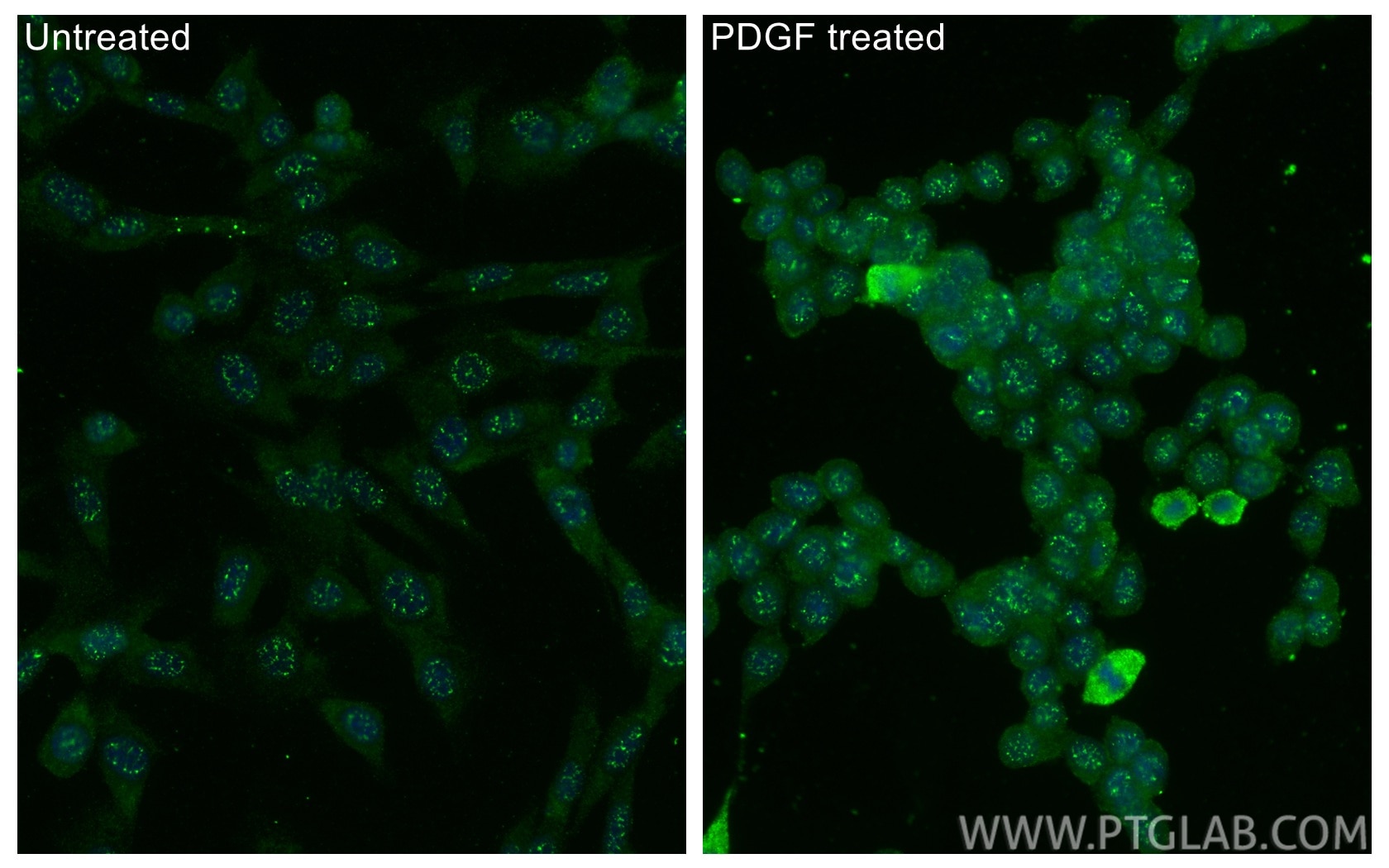IF Staining of NIH/3T3 using 29107-1-AP Immunofluorescence (IF) / fluorescent staining of NIH/3T3 cells using Phospho-PKN1 (Thr774) Polyclonal antibody (29107-1-AP)