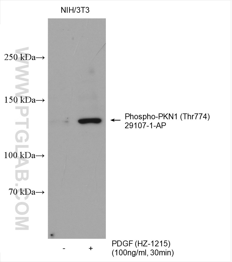 Western Blot (WB) analysis of various lysates using Phospho-PKN1 (Thr774) Polyclonal antibody (29107-1-AP)