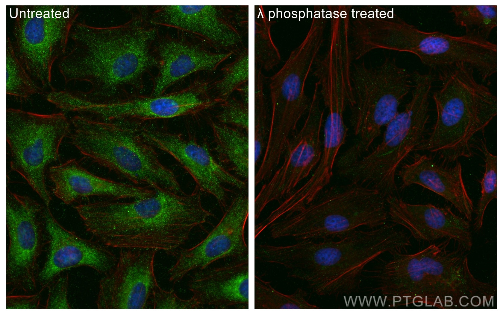 Immunofluorescence (IF) / fluorescent staining of HeLa cells using Phospho-PLA2G4A (Ser505) Polyclonal antibody (28925-1-AP)