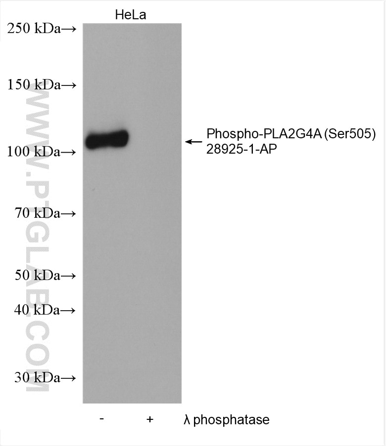 Western Blot (WB) analysis of various lysates using Phospho-PLA2G4A (Ser505) Polyclonal antibody (28925-1-AP)