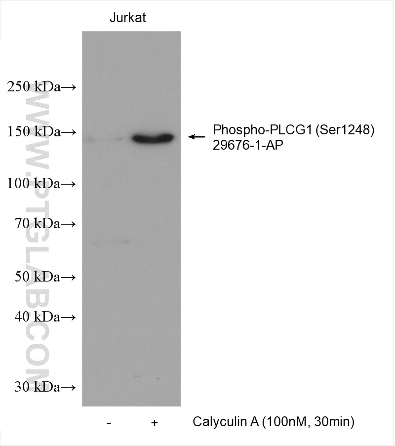 Phospho-PLCG1 (Ser1248)