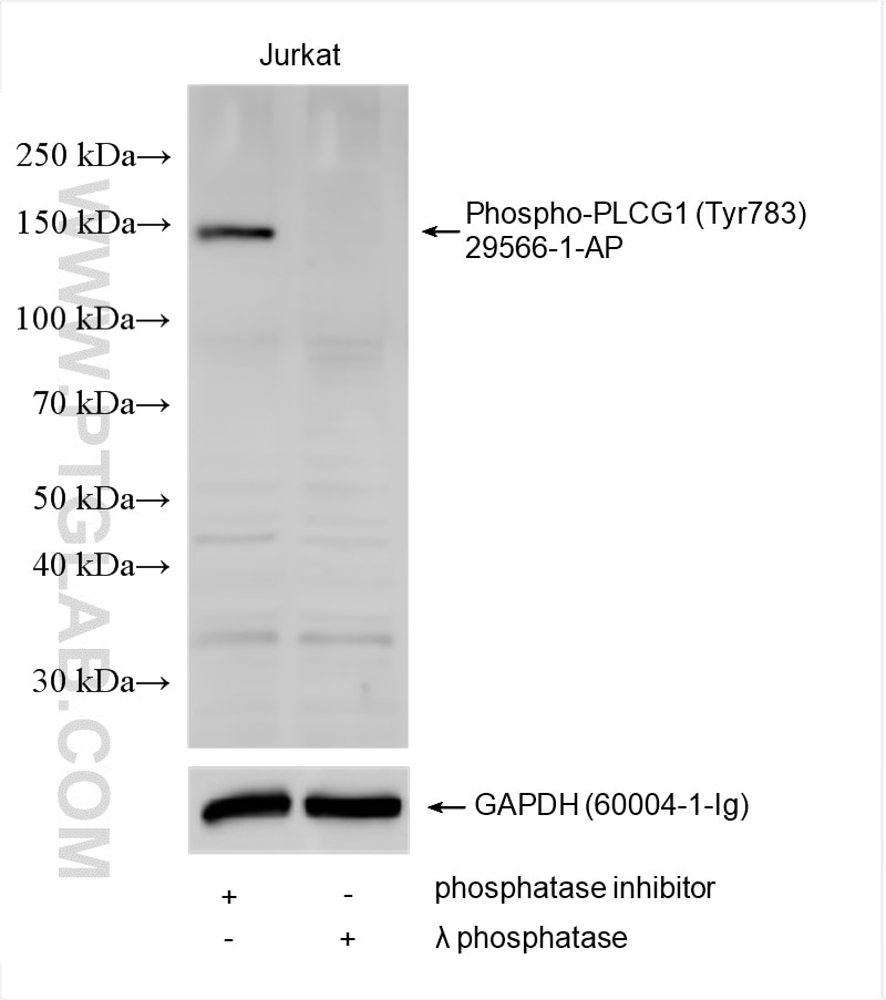 Western Blot (WB) analysis of various lysates using Phospho-PLCG1 (Tyr783) Polyclonal antibody (29566-1-AP)