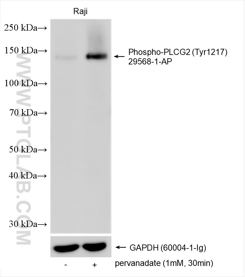 Phospho-PLCG2 (Tyr1217)