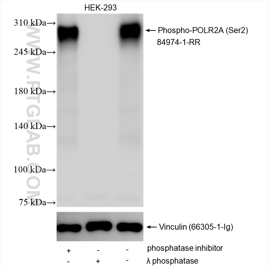 Western Blot (WB) analysis of various lysates using Phospho-POLR2A (Ser2) Recombinant antibody (84974-1-RR)