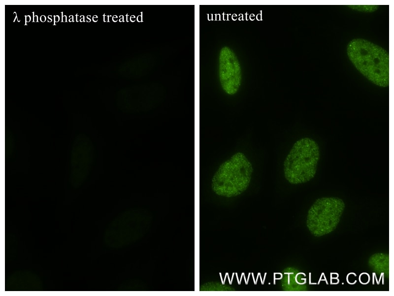 Immunofluorescence (IF) / fluorescent staining of HeLa cells using Phospho-POLR2A (Ser5) Recombinant antibody (84834-1-RR)