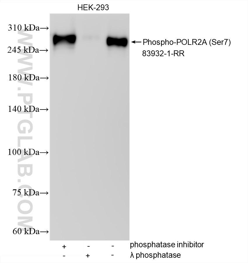 Western Blot (WB) analysis of various lysates using Phospho-POLR2A (Ser7) Recombinant antibody (83932-1-RR)