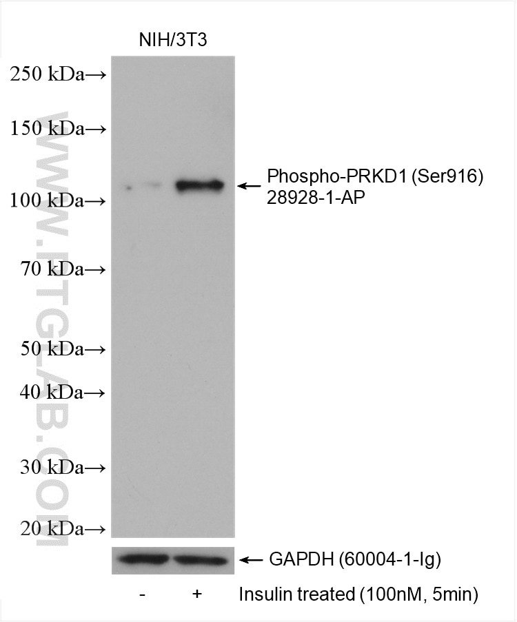 Western Blot (WB) analysis of various lysates using Phospho-PRKD1 (Ser916) Polyclonal antibody (28928-1-AP)