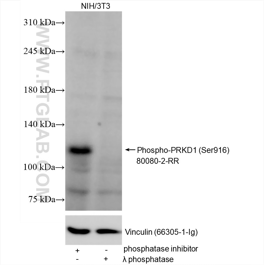 Western Blot (WB) analysis of various lysates using Phospho-PRKD1 (Ser916) Recombinant antibody (80080-2-RR)