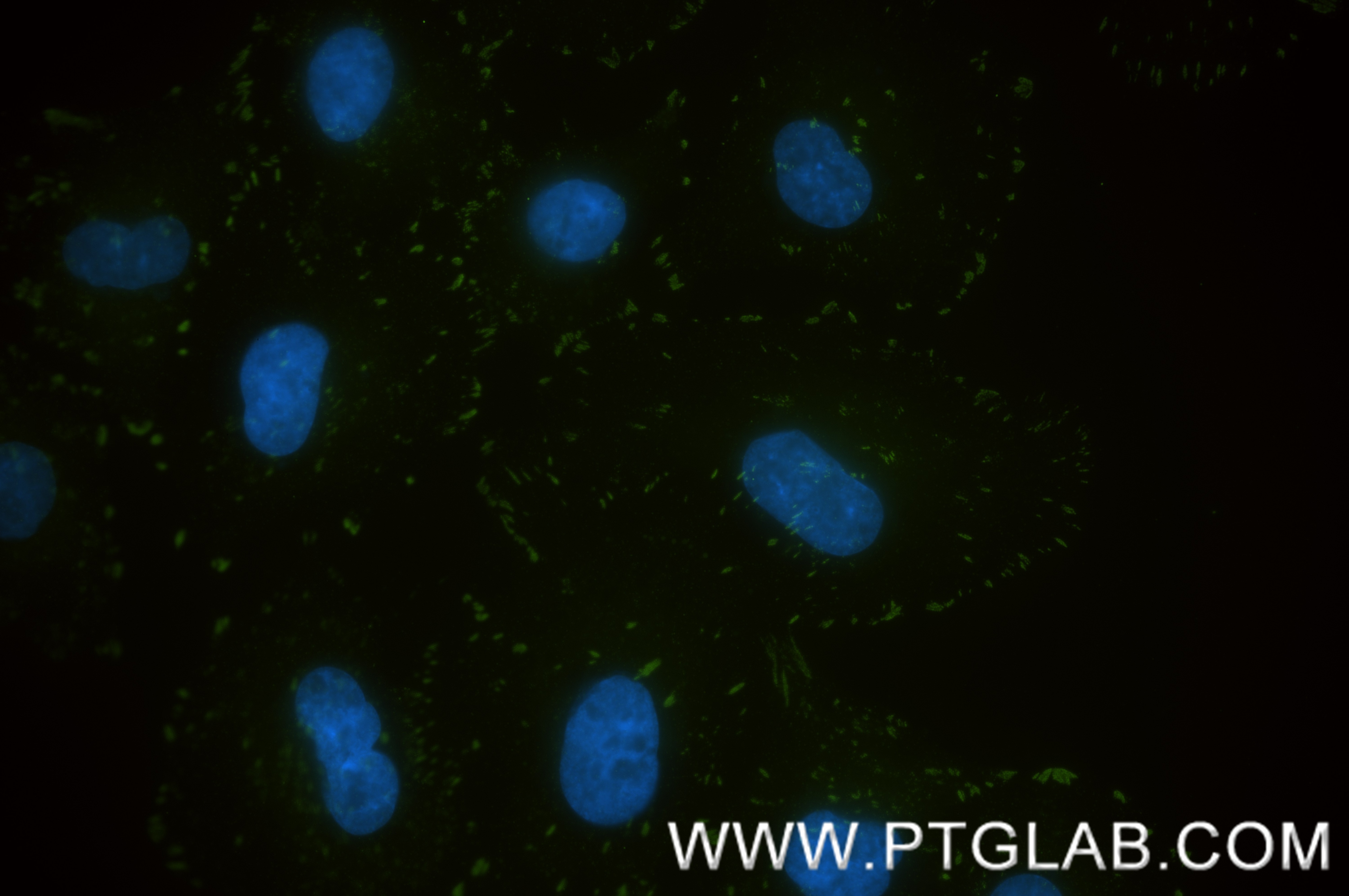 Immunofluorescence (IF) / fluorescent staining of A549 cells using Phospho-Paxillin (Tyr118) Recombinant monoclonal a (81180-2-RR)