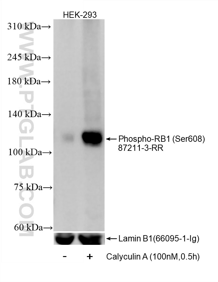 Non-treated HEK-293 cells and Calyculin A treated HEK-293 cells were subjected to SDS PAGE followed by western blot with 87211-3-RR (Phospho-RB1 (Ser608) antibody) at dilution of 1:5000 incubated at room temperature for 1.5 hours. The membrane was stripped and re-blotted with Lamin B1 (66095-1-Ig) antibody as a loading control. Western Blot (WB) analysis of HEK-293 cells using Phospho-RB1 (Ser608) Recombinant monoclonal antibo (87211-3-RR)