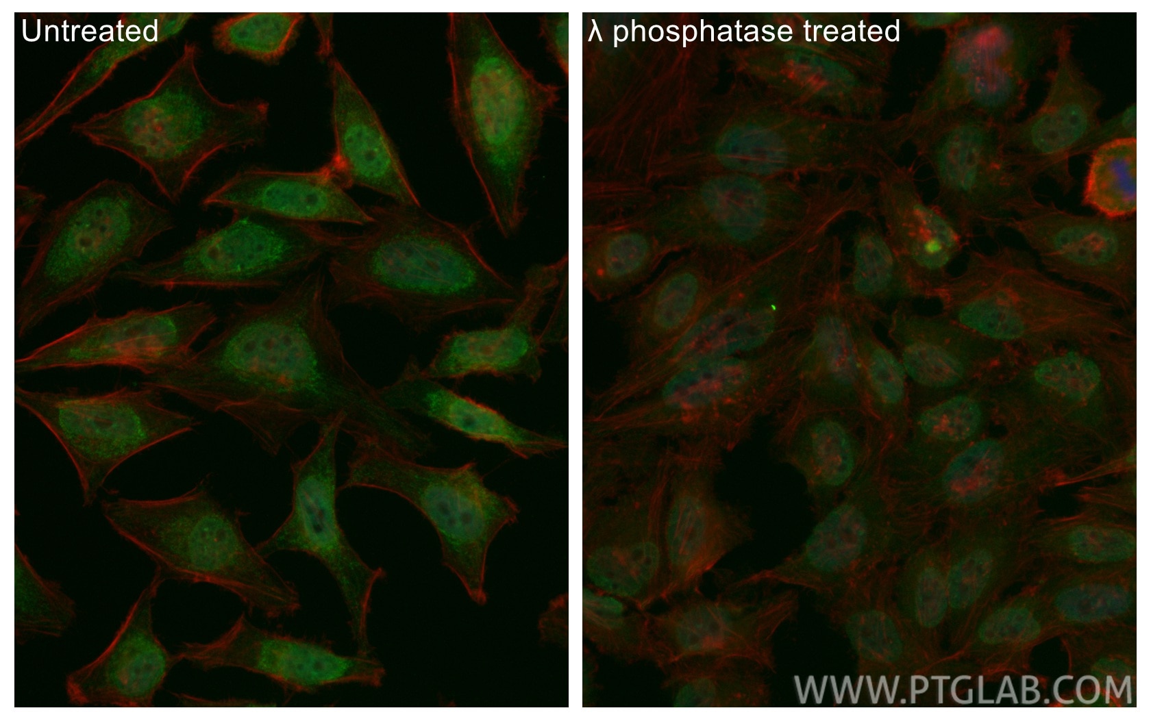 IF Staining of HeLa using CL488-84692 Immunofluorescence (IF) / fluorescent staining of HeLa cells using CoraLite® Plus 488-conjugated Phospho-RB1 (Ser780) (CL488-84692)