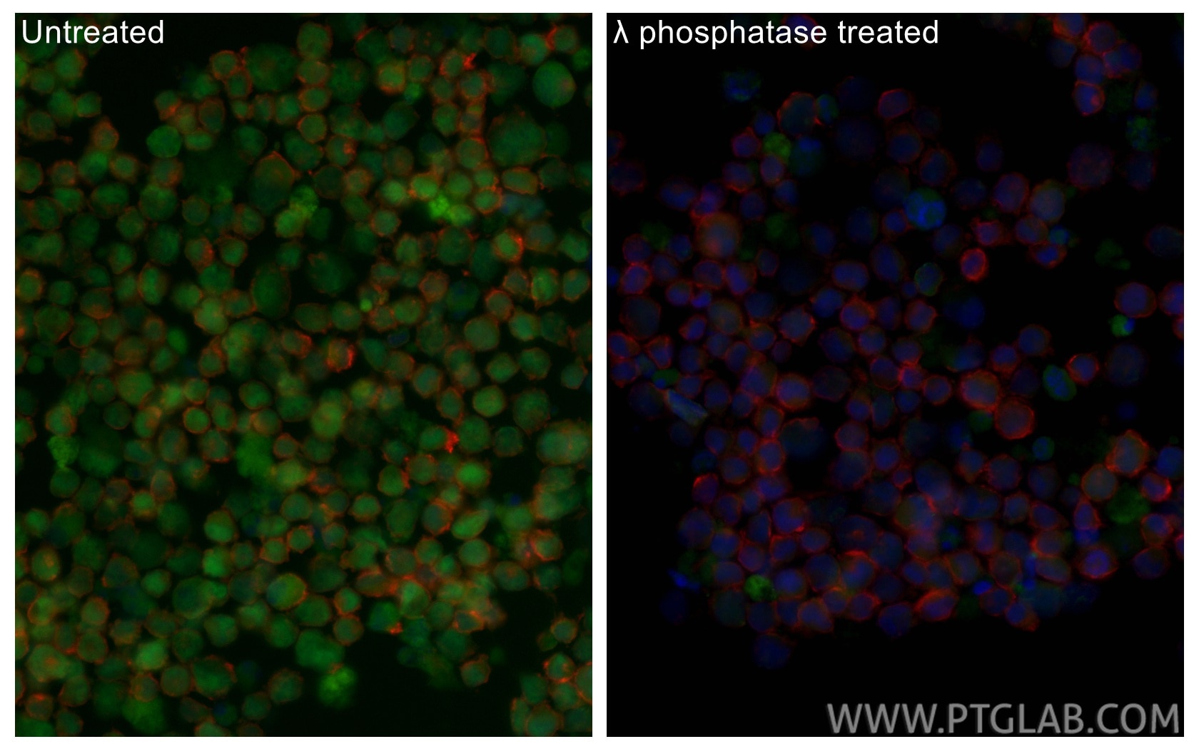 IF Staining of K-562 using CL488-84692 Immunofluorescence (IF) / fluorescent staining of K-562 cells using CoraLite® Plus 488-conjugated Phospho-RB1 (Ser780) (CL488-84692)