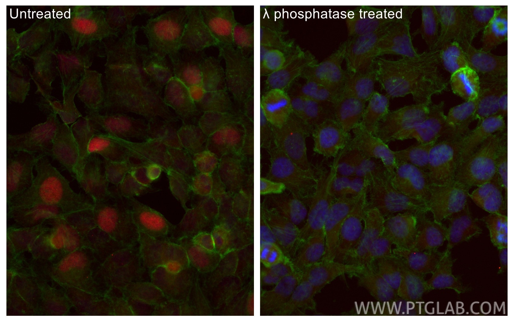 IF Staining of HeLa using CL594-84692 Immunofluorescence (IF) / fluorescent staining of HeLa cells using CoraLite®594-conjugated Phospho-RB1 (Ser780) Recom (CL594-84692)
