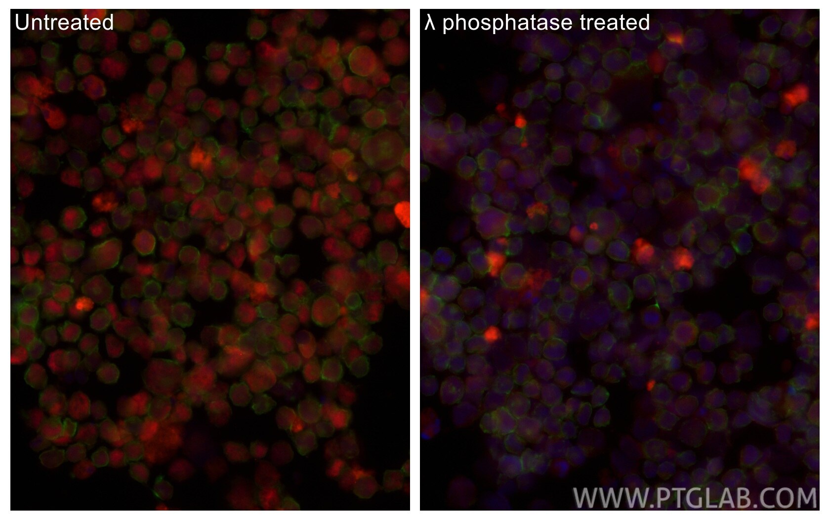 IF Staining of K-562 using CL594-84692 Immunofluorescence (IF) / fluorescent staining of K-562 cells using CoraLite®594-conjugated Phospho-RB1 (Ser780) Recom (CL594-84692)
