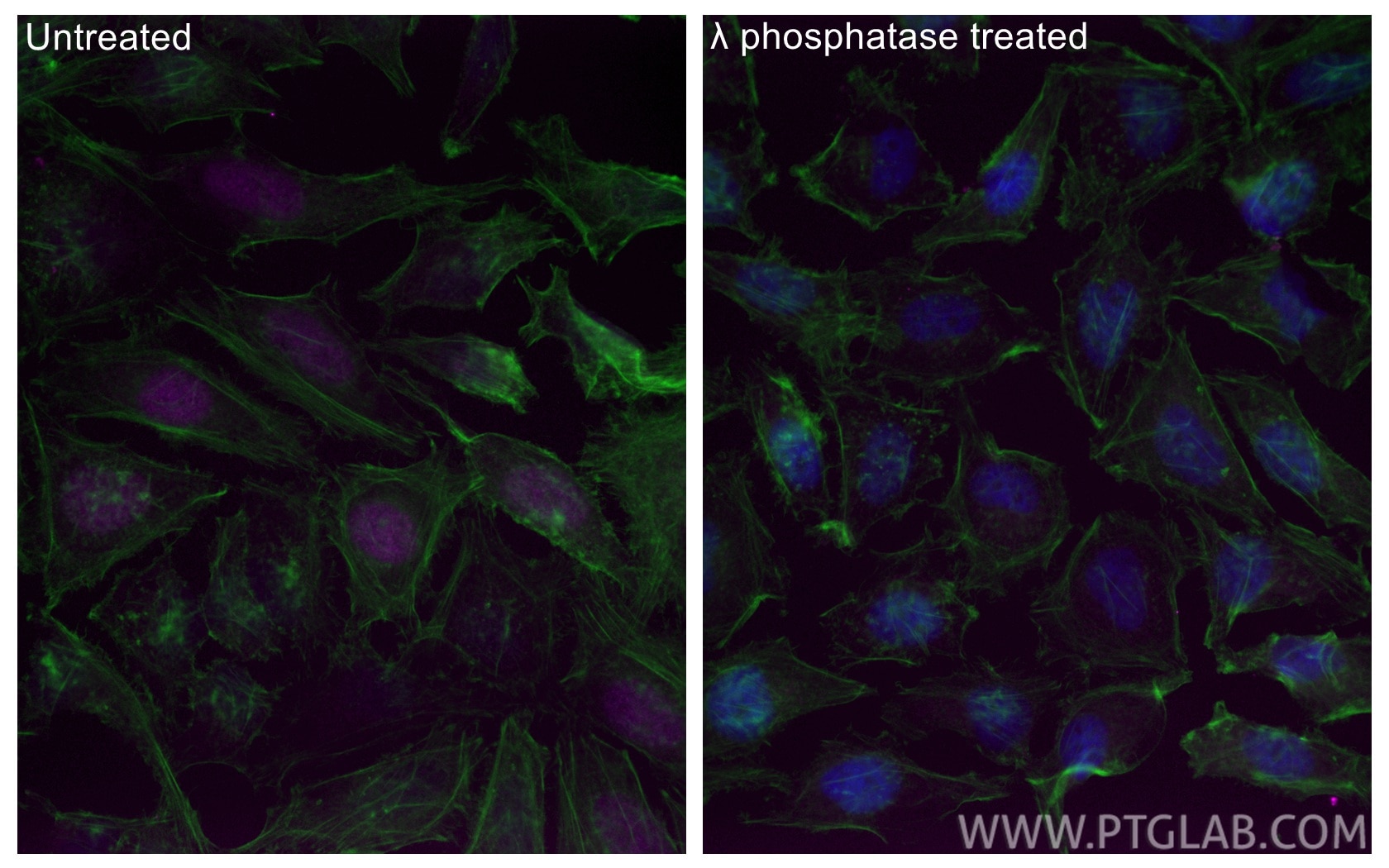 IF Staining of HeLa using CL647-84692 Immunofluorescence (IF) / fluorescent staining of HeLa cells using CoraLite® Plus 647-conjugated Phospho-RB1 (Ser780) (CL647-84692)