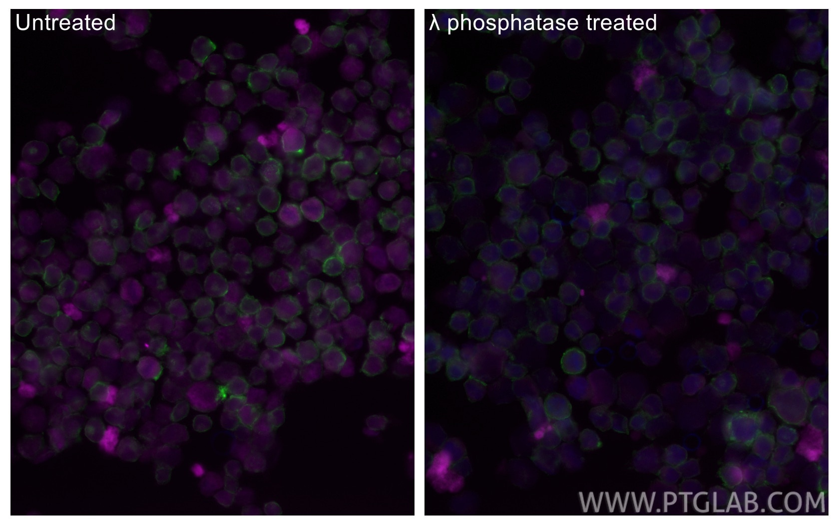 IF Staining of K-562 using CL647-84692 Immunofluorescence (IF) / fluorescent staining of K-562 cells using CoraLite® Plus 647-conjugated Phospho-RB1 (Ser780) (CL647-84692)
