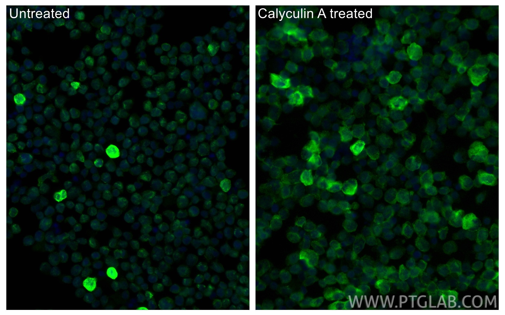IF Staining of Jurkat using 30376-1-AP Immunofluorescence (IF) / fluorescent staining of Jurkat cells using Phospho-RB1 (Ser807/811) Polyclonal antibody (30376-1-AP)