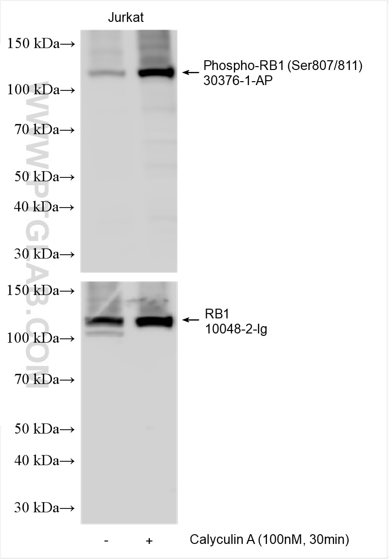 Western Blot (WB) analysis of various lysates using Phospho-RB1 (Ser807/811) Polyclonal antibody (30376-1-AP)