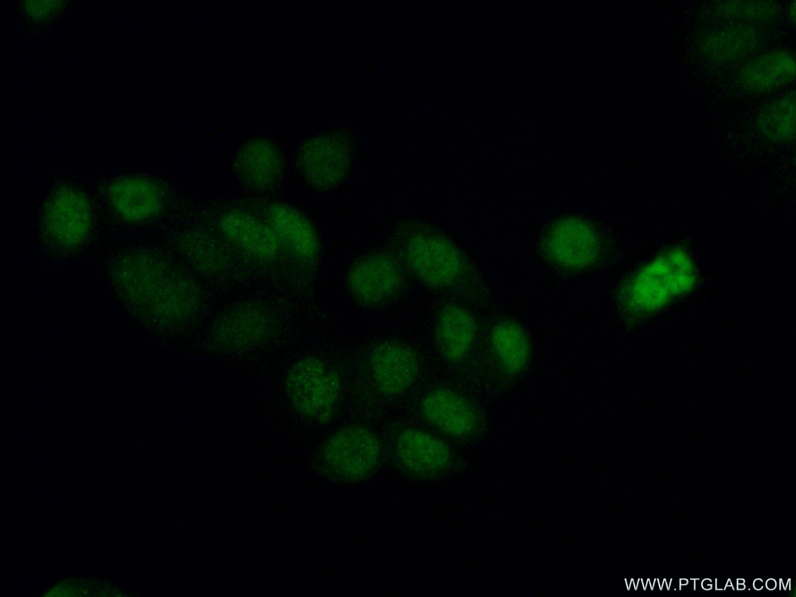 Phospho-RCC1 (Ser11)