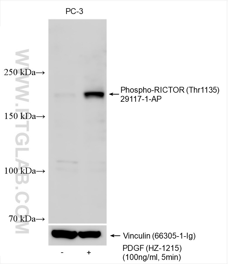 Western Blot (WB) analysis of various lysates using Phospho-RICTOR (Thr1135) Polyclonal antibody (29117-1-AP)