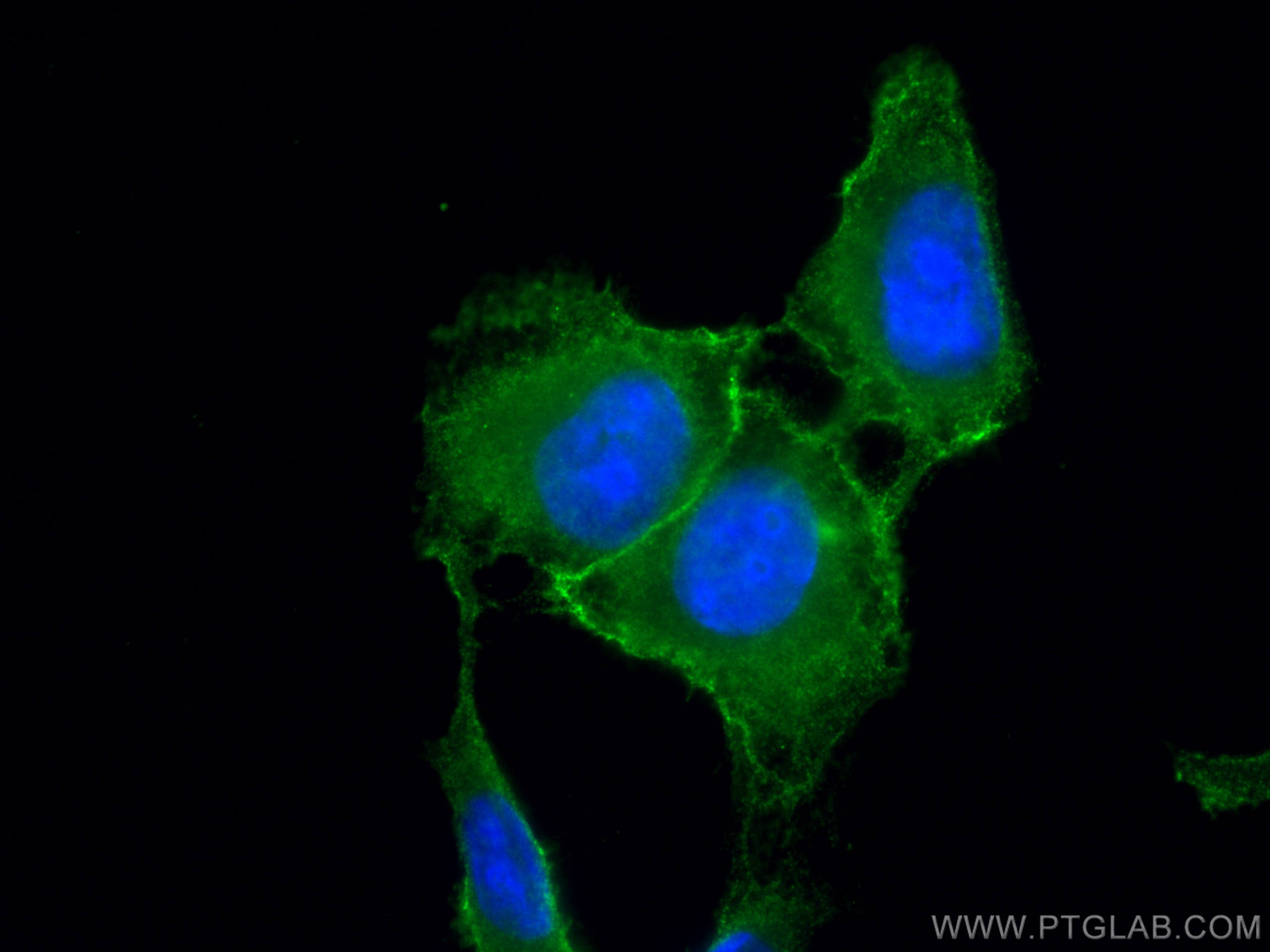 Immunofluorescence (IF) / fluorescent staining of U2OS cells using CoraLite® Plus 488-conjugated Phospho-RIPK1 (Ser16 (CL488-66854)
