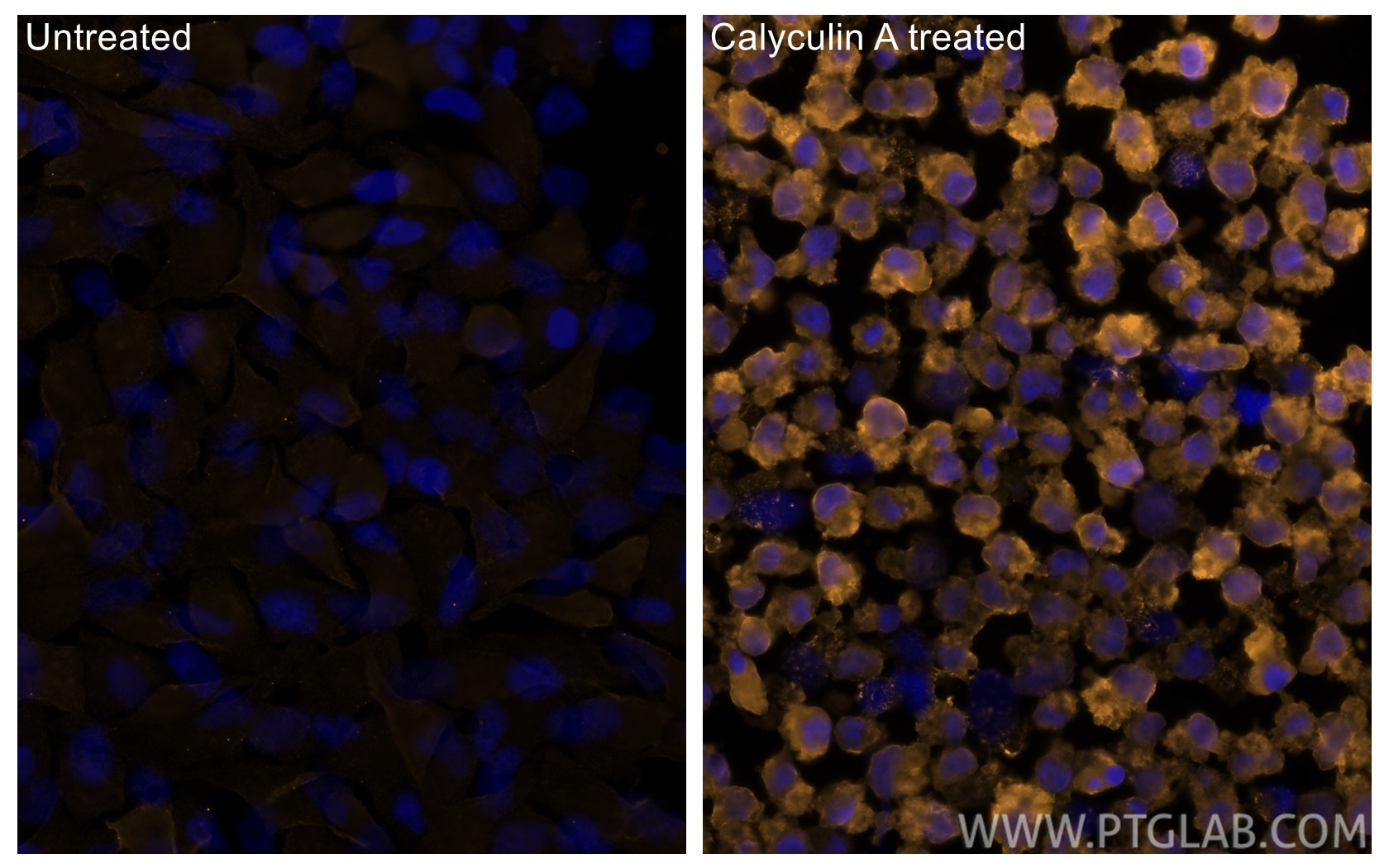 Immunofluorescence (IF) / fluorescent staining of HeLa cells using CoraLite®555-conjugated Phospho-RIPK1 (Ser161)  Mo (CL555-66854)