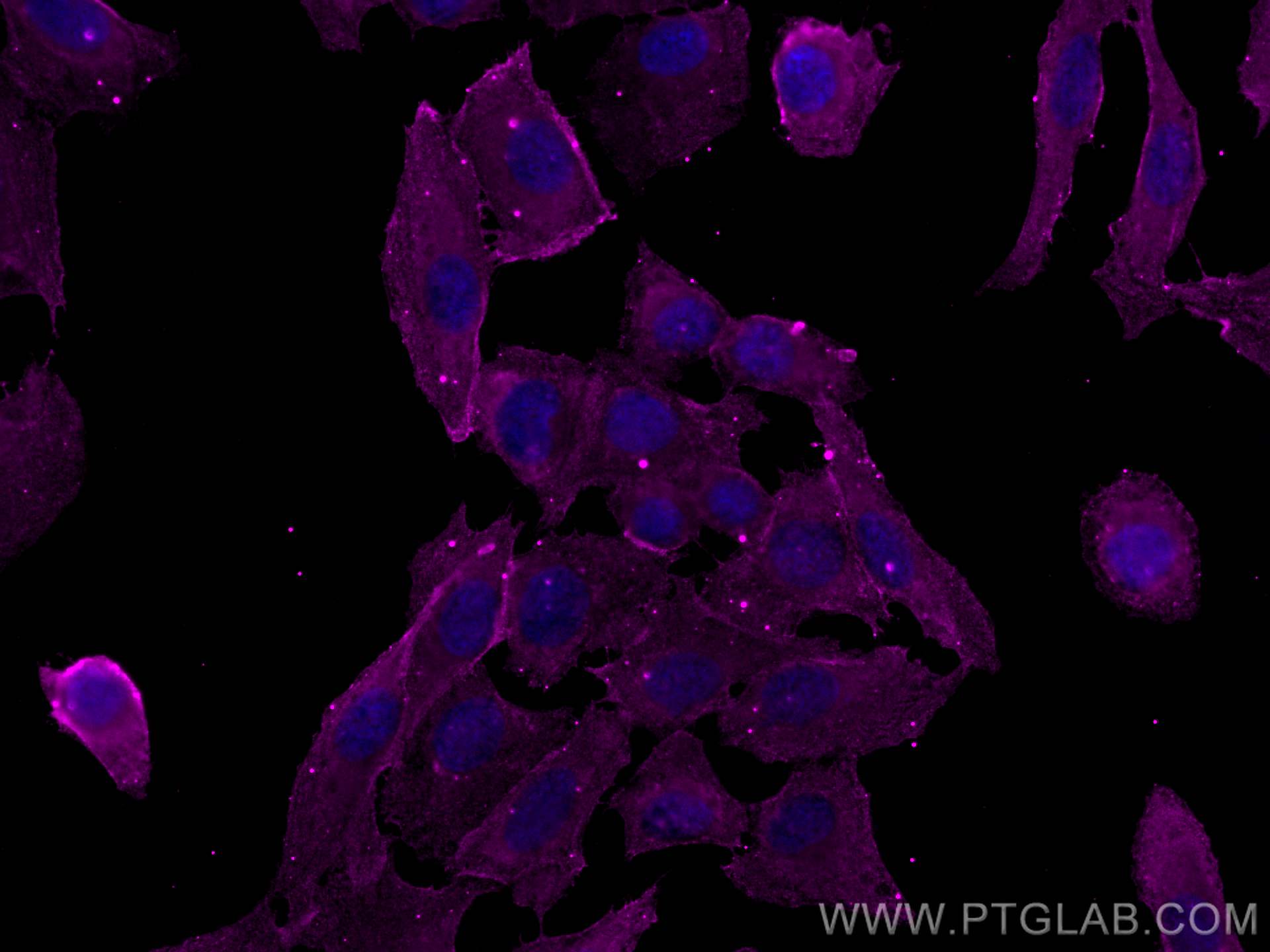 Immunofluorescence (IF) / fluorescent staining of U2OS cells using CoraLite® Plus 647-conjugated Phospho-RIPK1 (Ser16 (CL647-66854)