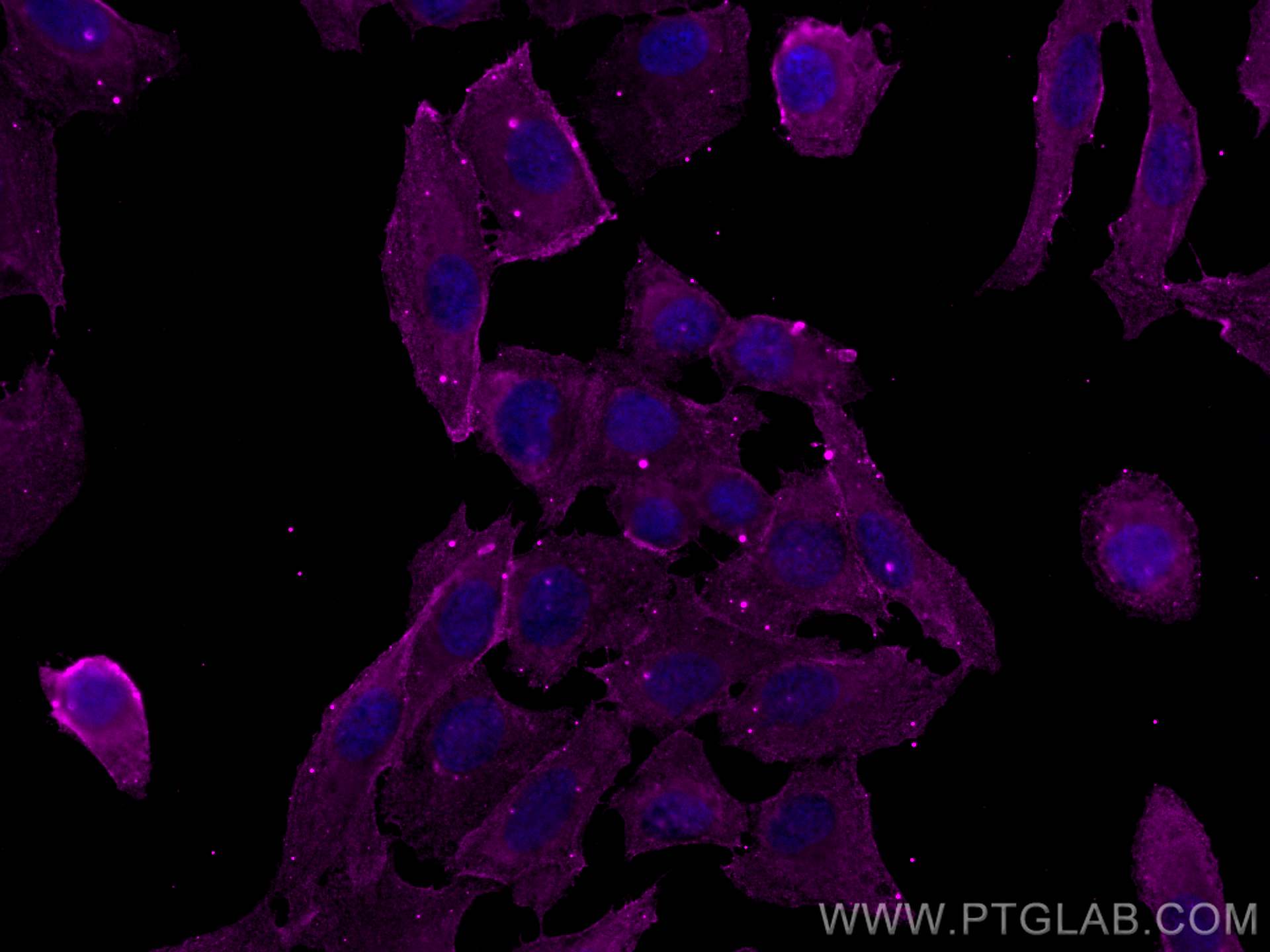 IF Staining of U2OS using CL647-66854