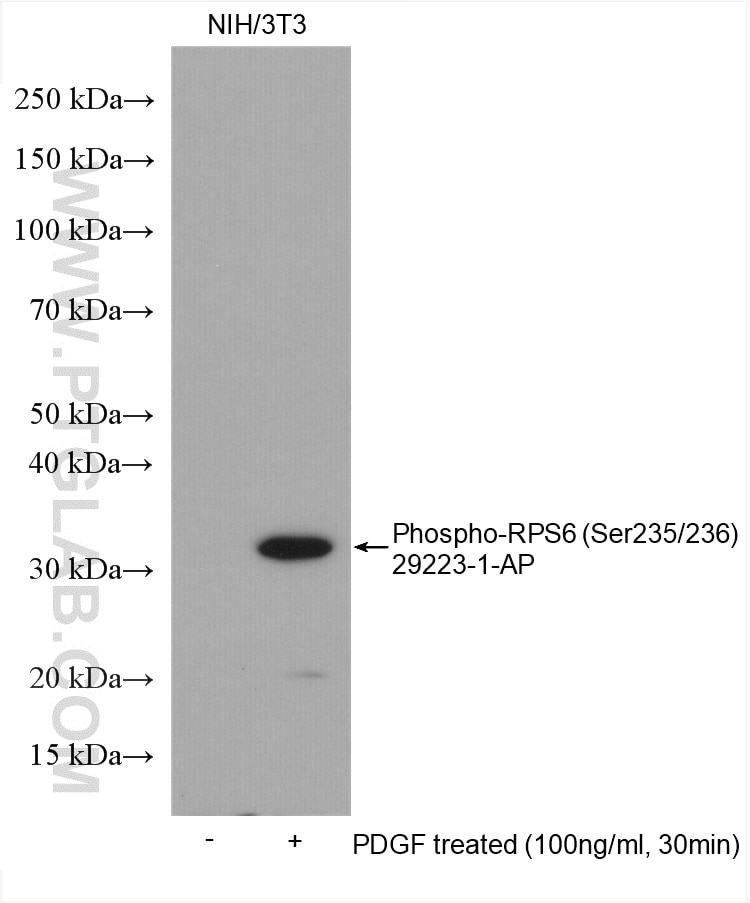 Phospho-S6 Ribosomal protein (Ser235/236)