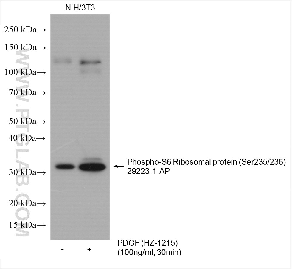 Western Blot (WB) analysis of various lysates using Phospho-S6 Ribosomal protein (Ser235/236) Polyclon (29223-1-AP)