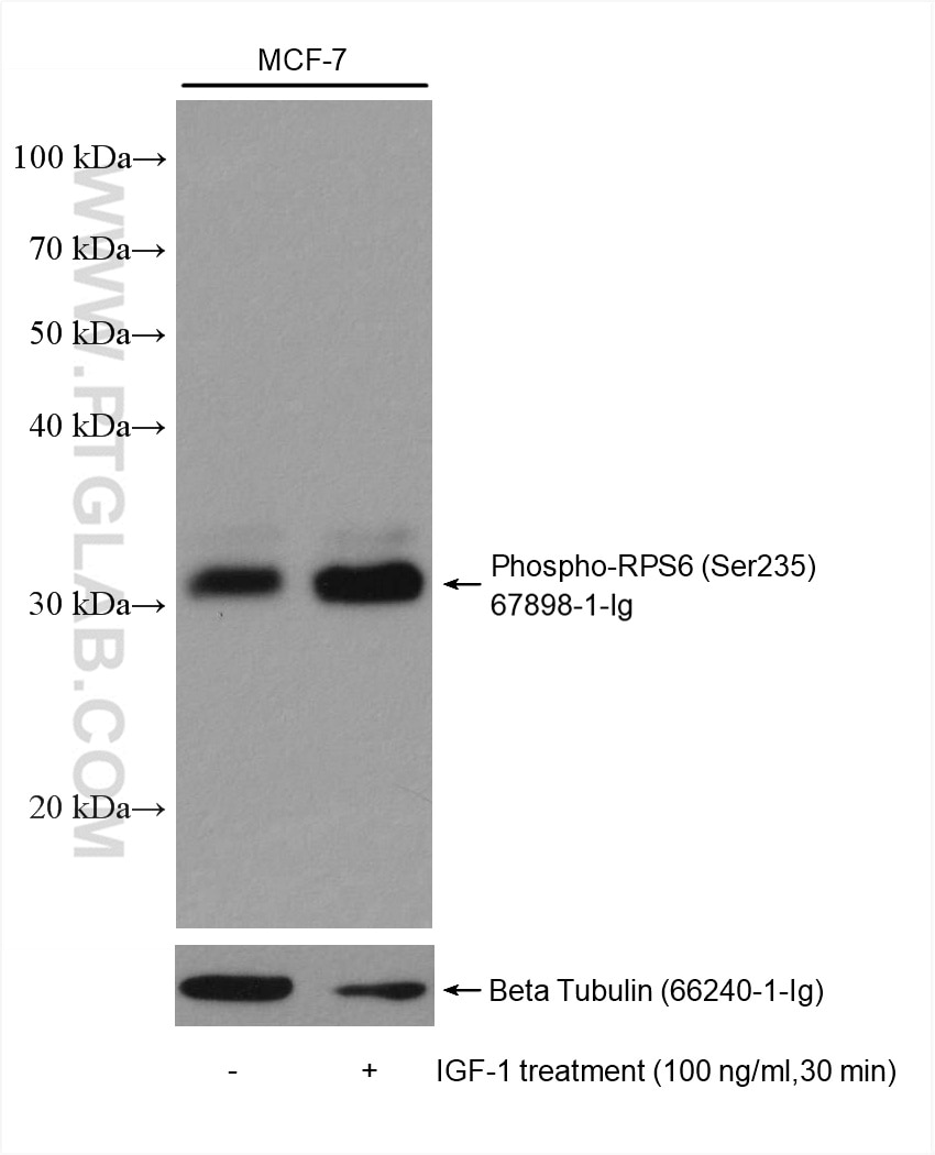 Western Blot (WB) analysis of various lysates using Phospho-S6 Ribosomal protein (Ser235) Monoclonal a (67898-1-Ig)