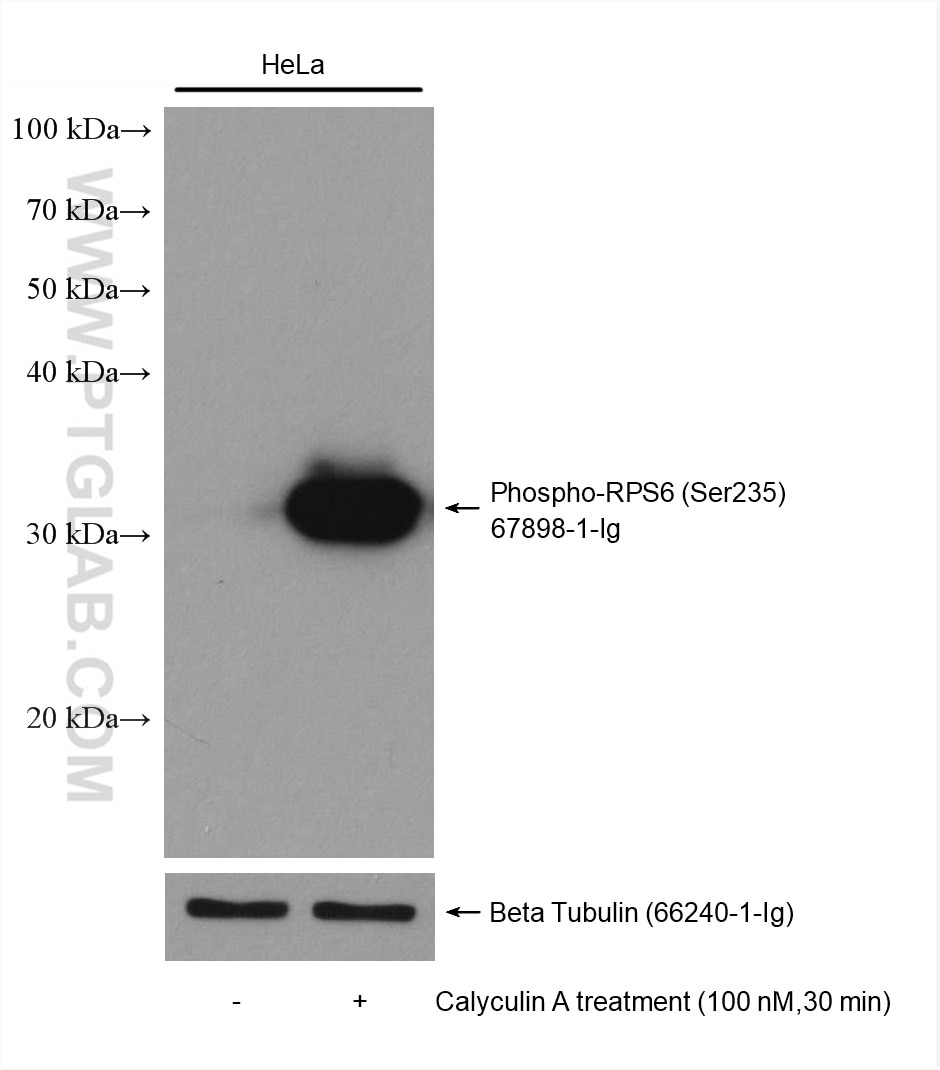 Western Blot (WB) analysis of various lysates using Phospho-S6 Ribosomal protein (Ser235) Monoclonal a (67898-1-Ig)