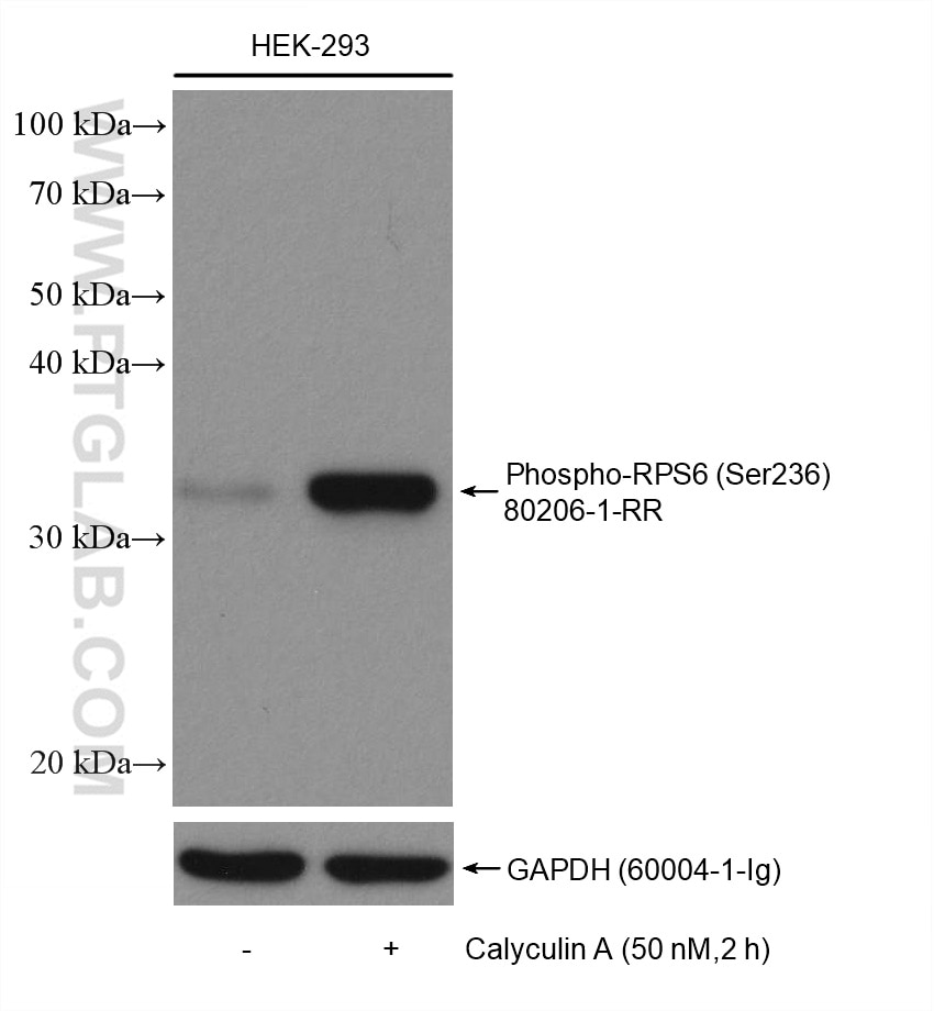 Western Blot (WB) analysis of various lysates using Phospho-S6 Ribosomal protein (Ser236) Recombinant  (80206-1-RR)