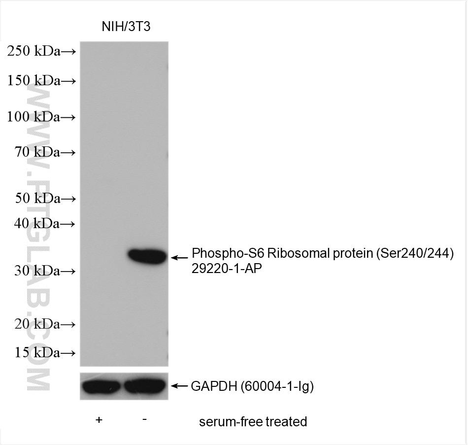 Western Blot (WB) analysis of various lysates using Phospho-S6 Ribosomal protein (Ser240/244) Polyclon (29220-1-AP)