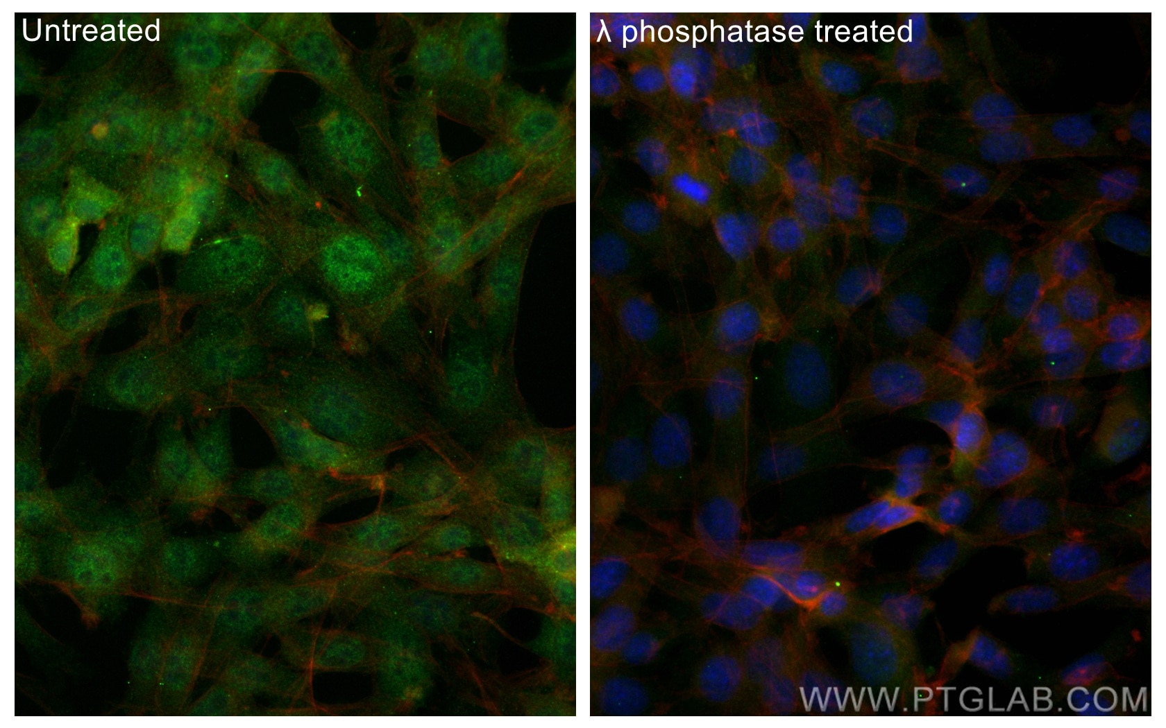Immunofluorescence (IF) / fluorescent staining of NIH/3T3 cells using Phospho-RPS6KA1 (Ser380) Polyclonal antibody (28983-1-AP)