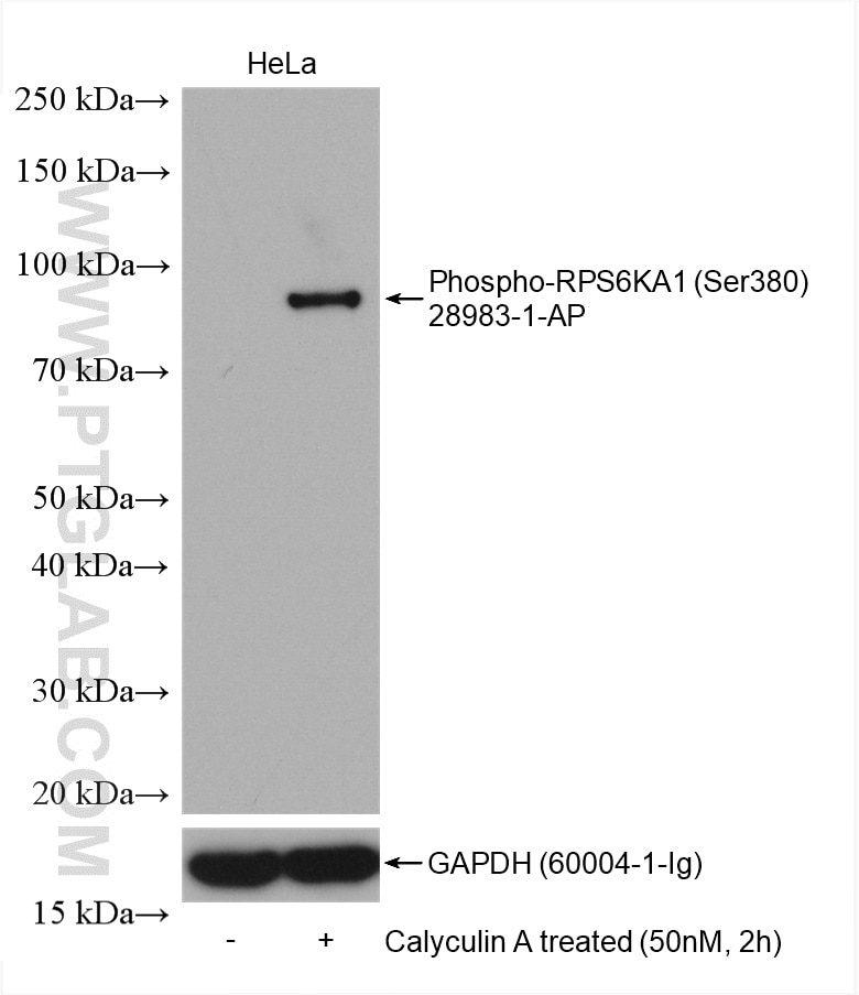 Western Blot (WB) analysis of HeLa cells using Phospho-RPS6KA1 (Ser380) Polyclonal antibody (28983-1-AP)