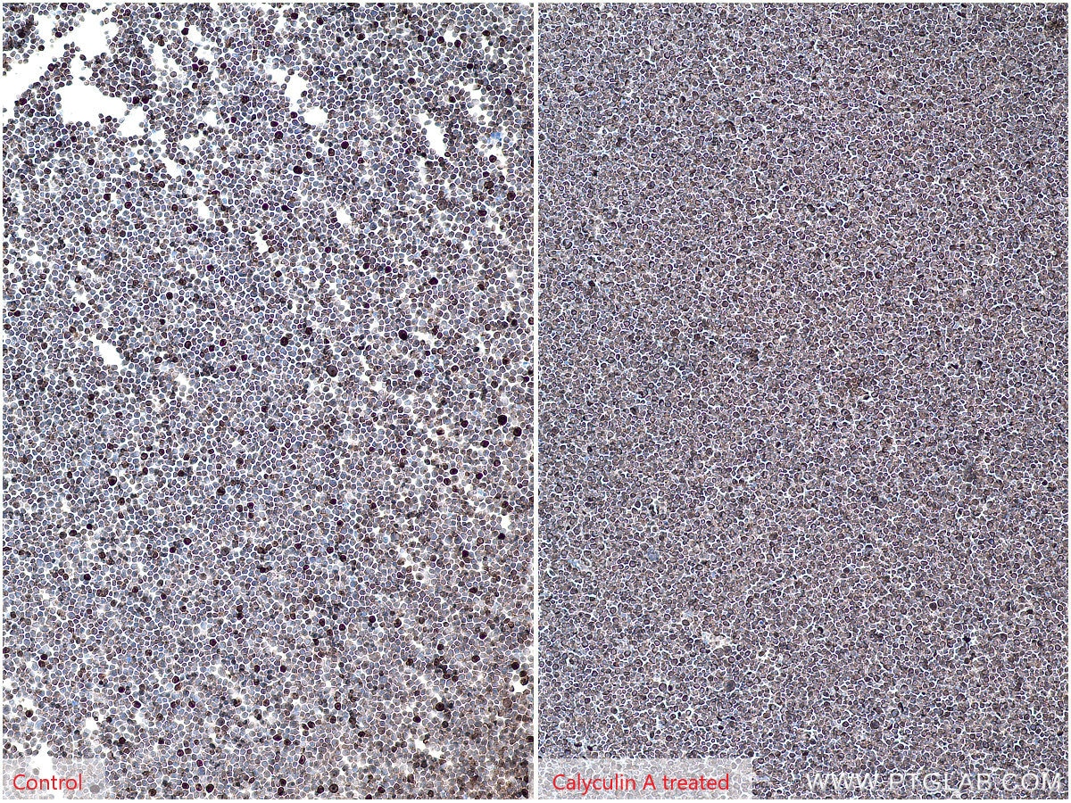 Immunohistochemistry (IHC) staining of Jurkat cells using Phospho-RPS6KA1 (Ser380) Recombinant antibody (80108-1-RR)