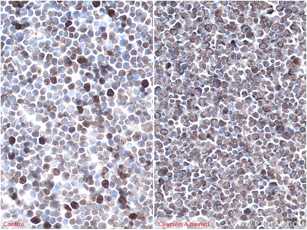 Immunohistochemistry (IHC) staining of Jurkat cells using Phospho-RPS6KA1 (Ser380) Recombinant antibody (80108-1-RR)
