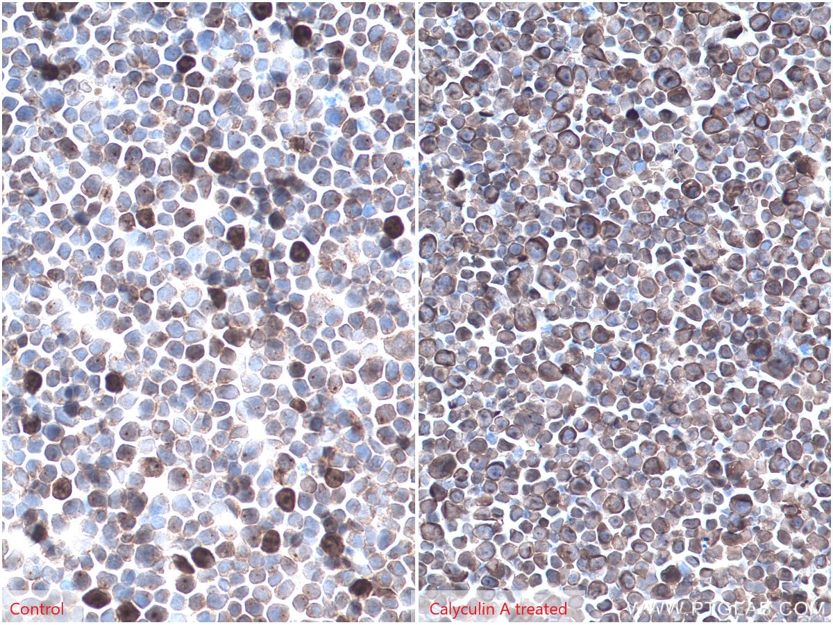 IHC staining of Jurkat using 80108-1-RR