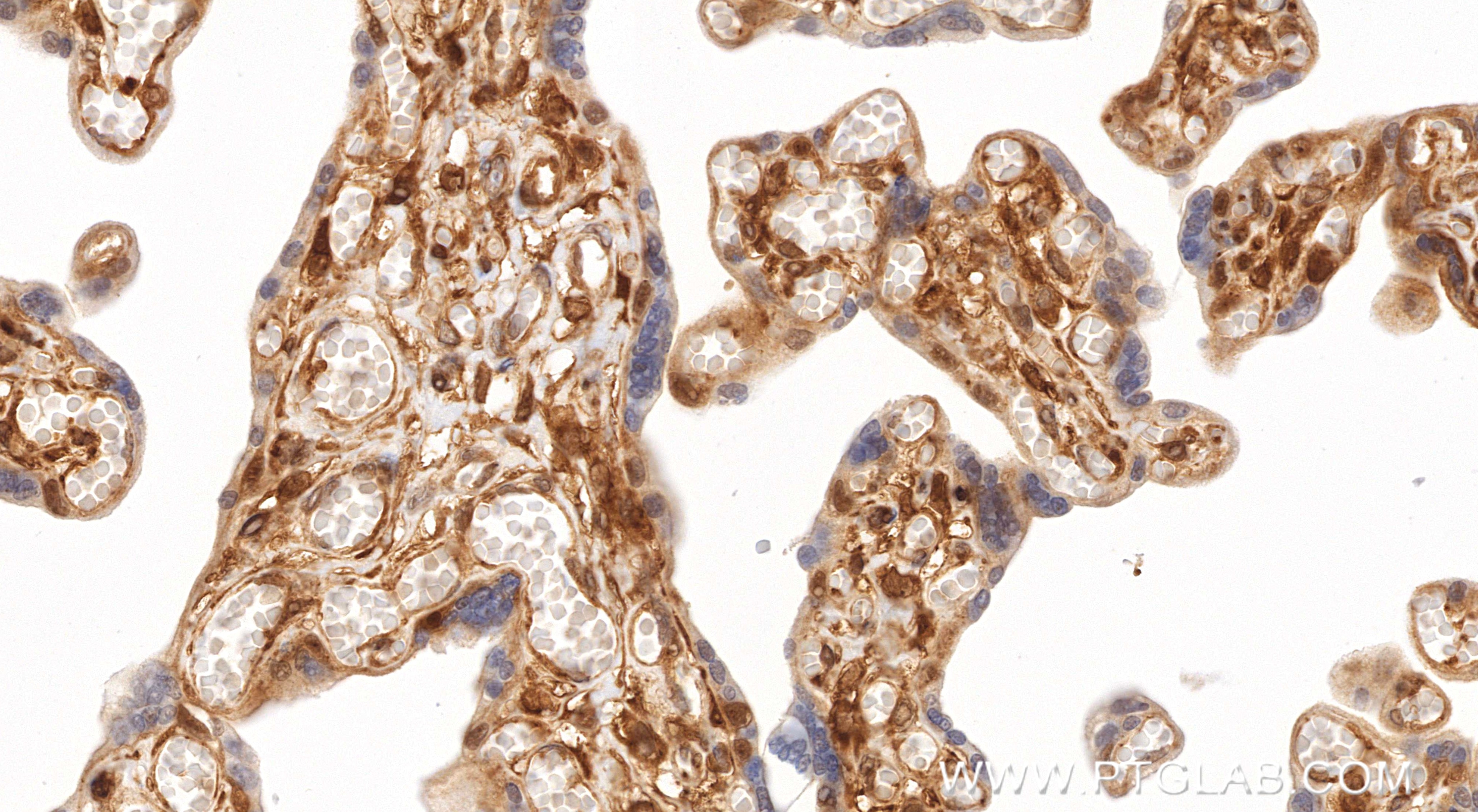 Immunohistochemistry (IHC) staining of human placenta tissue using Phospho-RPS6KA1 (Ser380) Recombinant monoclonal an (80108-1-RR)