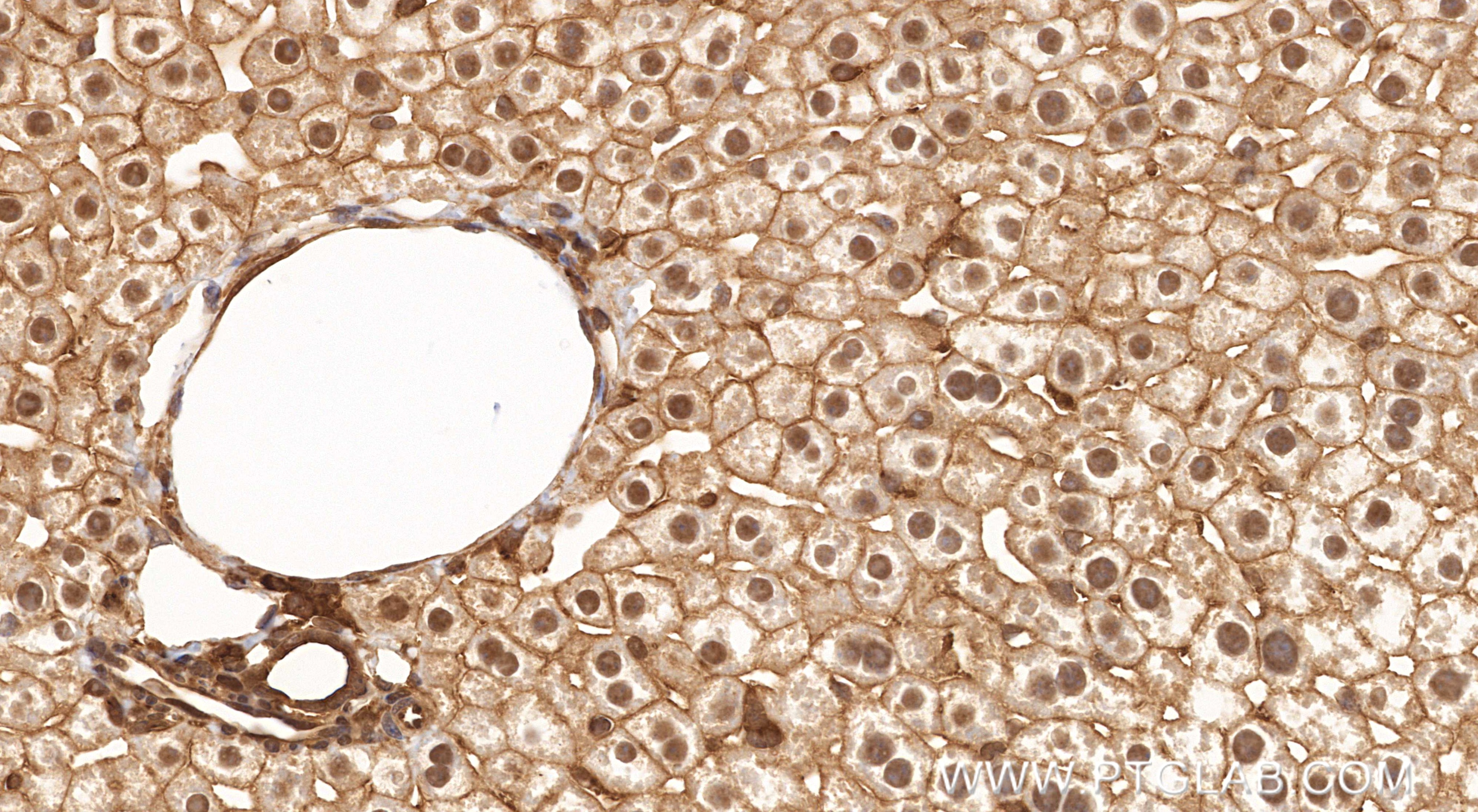 Immunohistochemistry (IHC) staining of mouse liver tissue using Phospho-RPS6KA1 (Ser380) Recombinant monoclonal an (80108-1-RR)